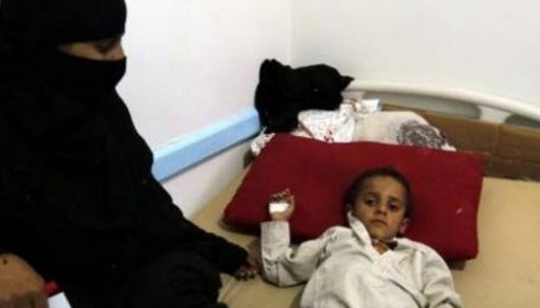 الكوليرا قد تتجاوز 300 ألف إصابة في اليمن في سبتمبر