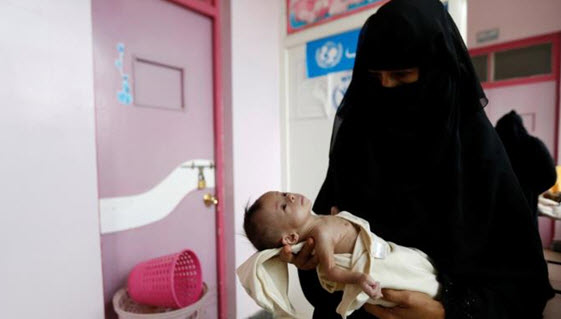 80% من أطفال اليمن بحاجة لمساعدة عاجلة