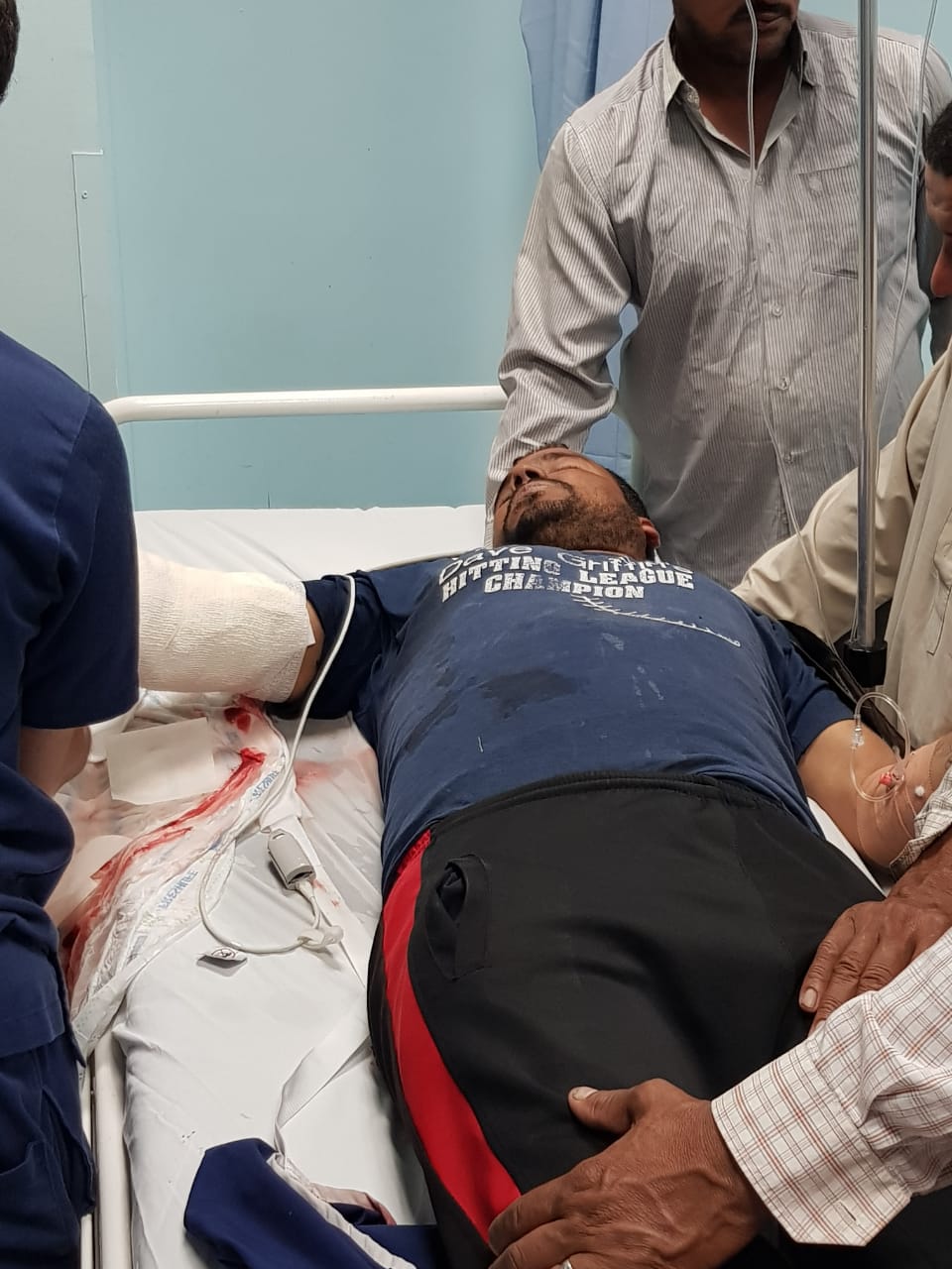اصابة عامل وطن بحادث دهس من ضاغطة بلديه جرش .. مصور