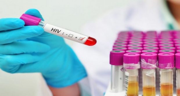 خطوة واحدة تفصل العلماء عن علاج الإيدز