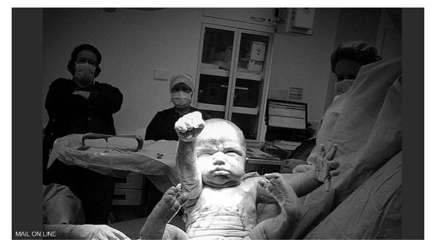 ولادة سوبرمان.. صورة مذهلة لأولى لحظات "الطفل الخارق"