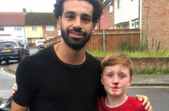 محمد صلاح ينقذ "الطفل النازف" ويرضيه بقيمص