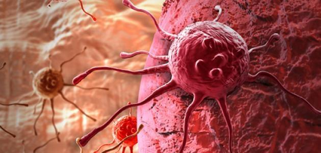 اكتشاف علاقة بين حالة الأوعية الدموية والسرطان 