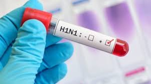 "الصحة" تعلن عن وفاة و8 اصابات بأنفلونزا الخنازير