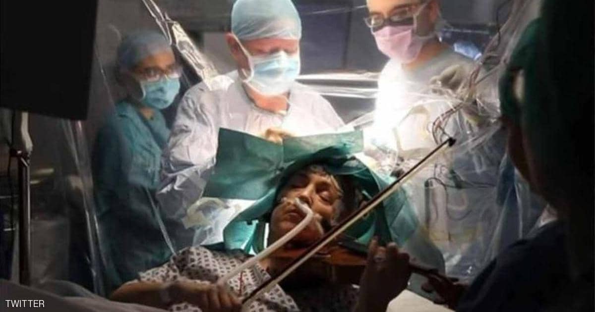 مريضة تعزف الكمان أثناء الخضوع لجراحة بالمخ