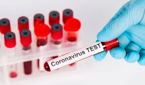 سحب 1000 عينة لمخالطي المصاب بفيروس كورونا في بلدة نحلة جرش