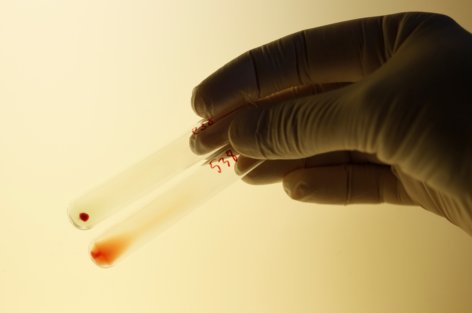 دراستان تكشفان عن فصيلة دم الأشخاص الأقل عرضة للإصابة بكورونا