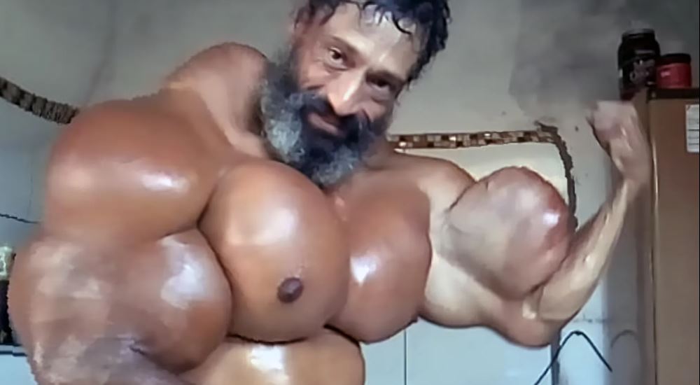 وفاة "الهلك" البرازيلي بحقنة زيت عضلات