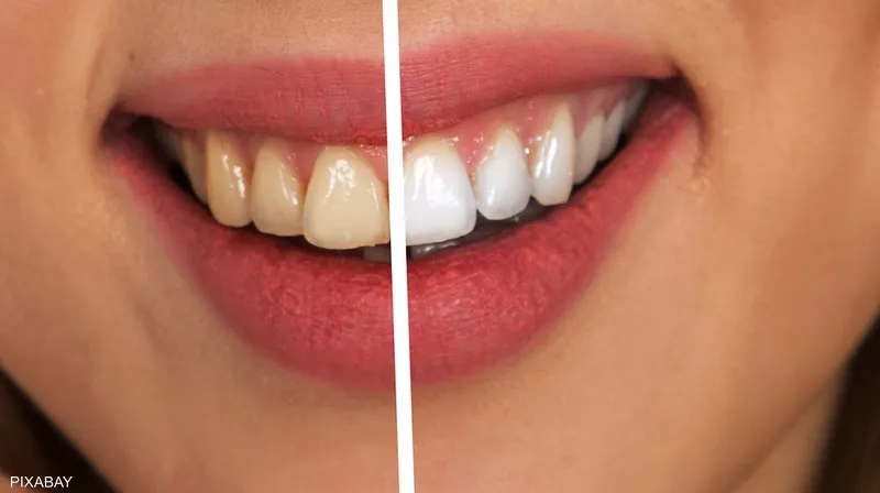 تؤثر سلبا على أسنانك.. 6 "تقليعات" للصحة والجمال انتبه منها