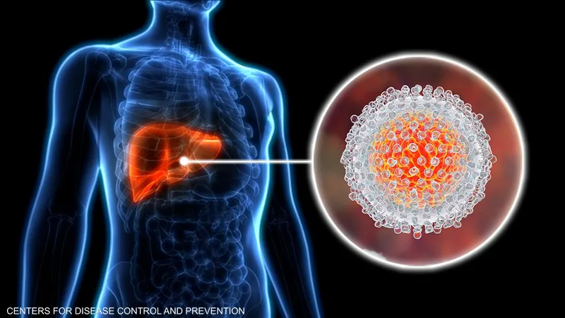 5 علامات تحذيرية قد تدل على "مشكل خطير" في الكبد