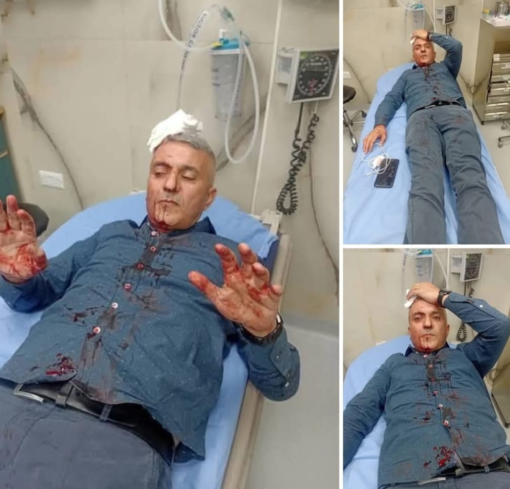 توقيف 5 اشخاص في قضية الاعتداء على الصحفي الحباشنة