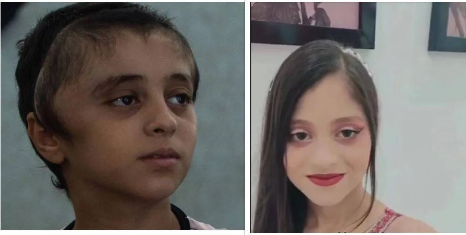 الطفلة مريم.. فقدت جزءاً من جمجمتها بشظية صاروخ وتبحث عن علاج خارج غزة