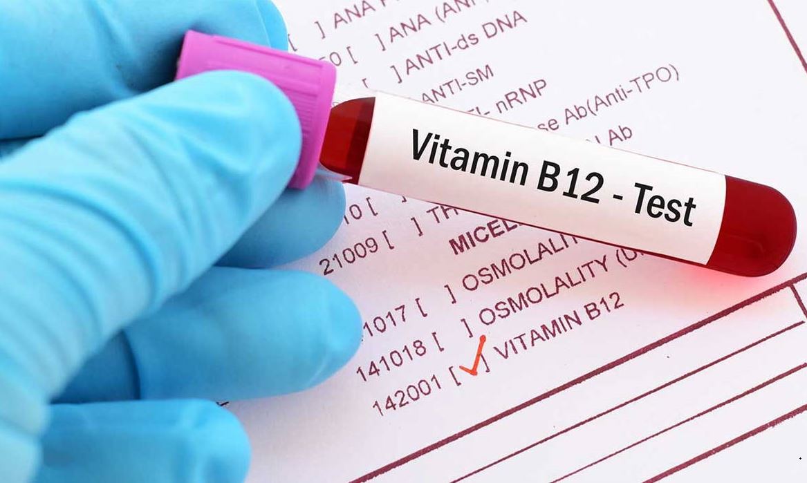 أعراض شائعة لنقص فيتامين B12 أحدها أكثر وضوحا في الصباح