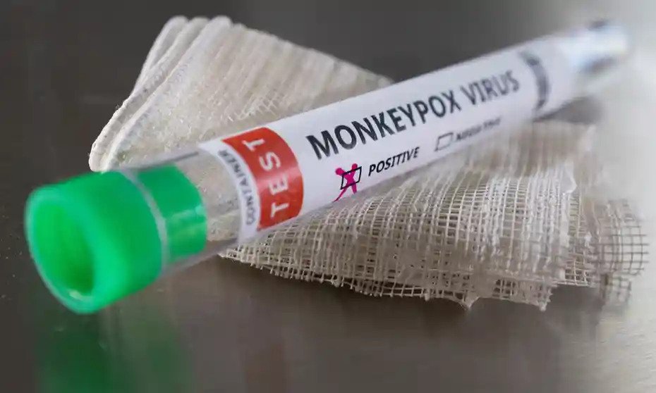 "الصحة العالمية" تعلق على التطعيم الجماعي ضد "جدري القرود"