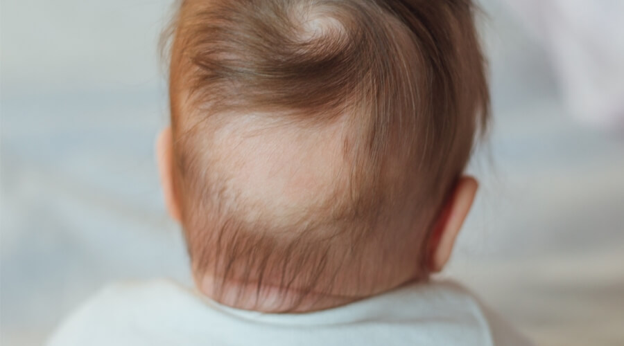 أسباب تساقط شعر المولود وكيفية الاهتمام به؟