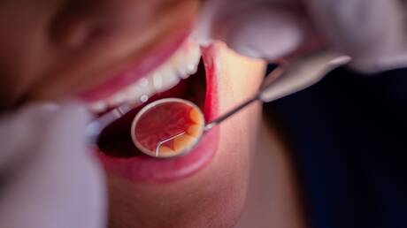 صحة الفم يمكن أن ترتبط بالعديد من الأمراض