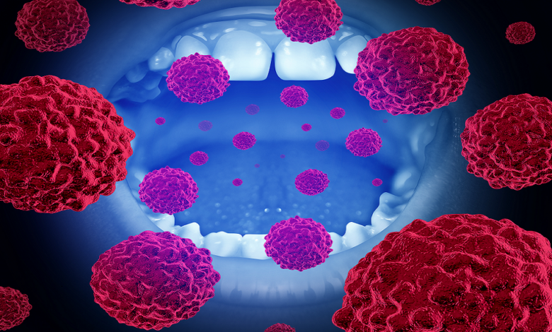 علماء يكشفون عن آلية تحول الخلايا السليمة إلى سرطانية في الفم