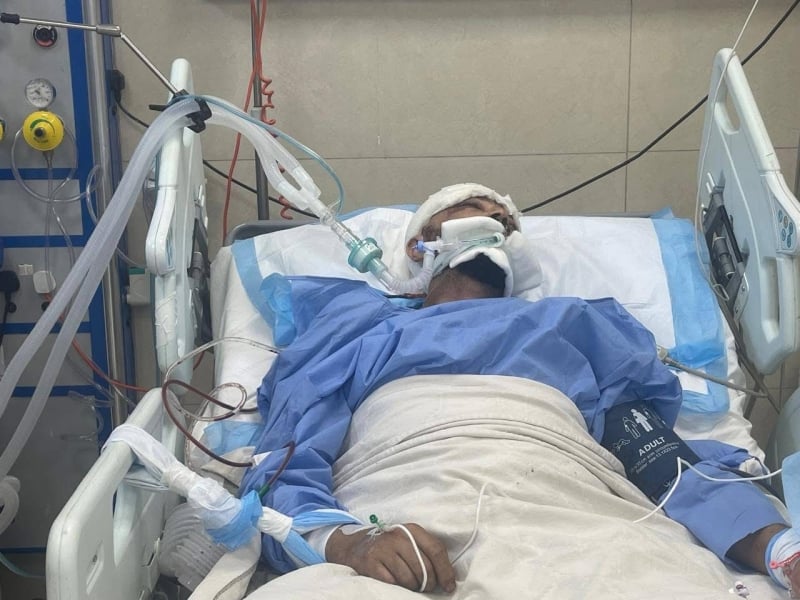 شاب يدخل العناية المركزة بعد تعرضه لضربة خلال مشاجرة قرب منزله