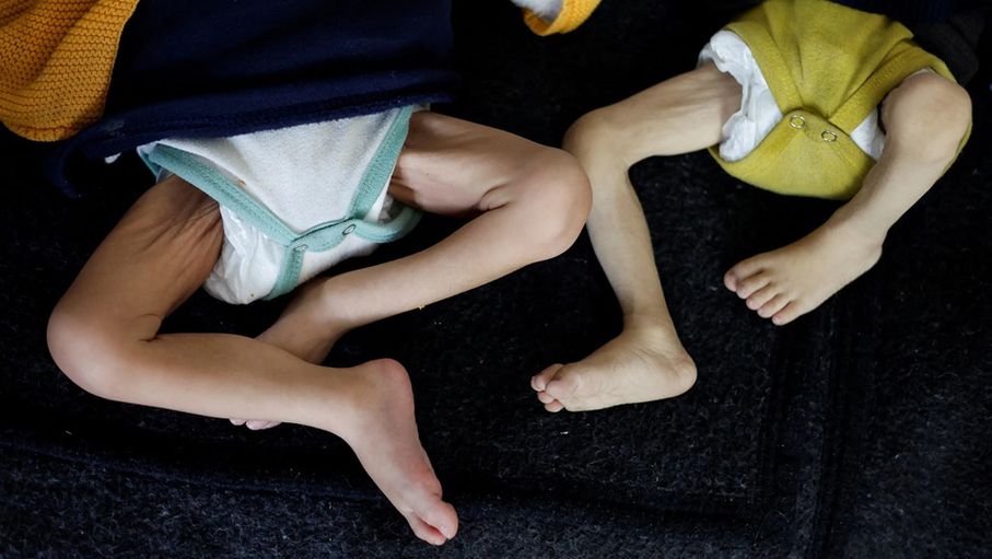 الأطفال يموتون جوعاً في #غزة