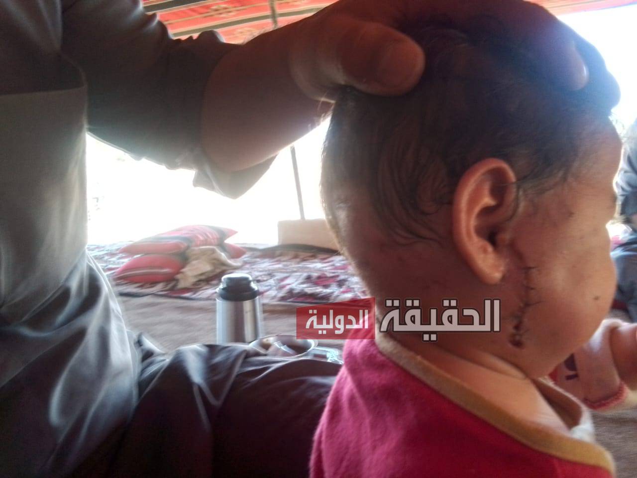 في حادثة مروّعة: أم تنقذ طفلتها من بين أنياب كلب ضال دخل منزلهما بمادبا.. ونقل المصابتين للمستشفى (فيديو - صور)